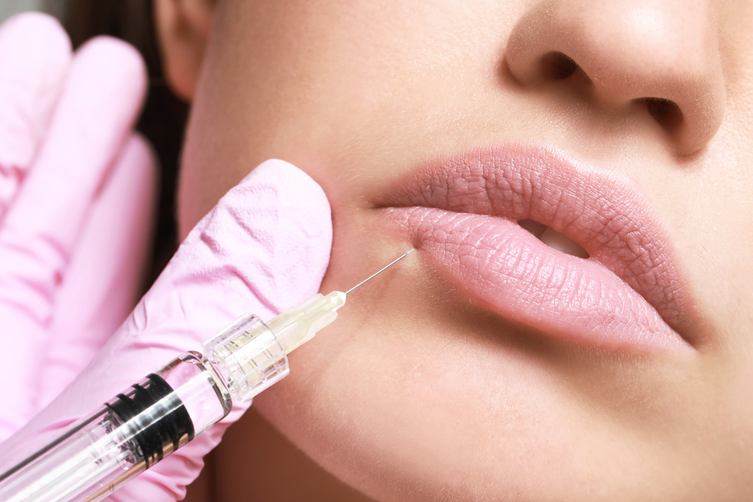 LIPPEN-BOOSTER - die Alternative zum Aufspritzen!