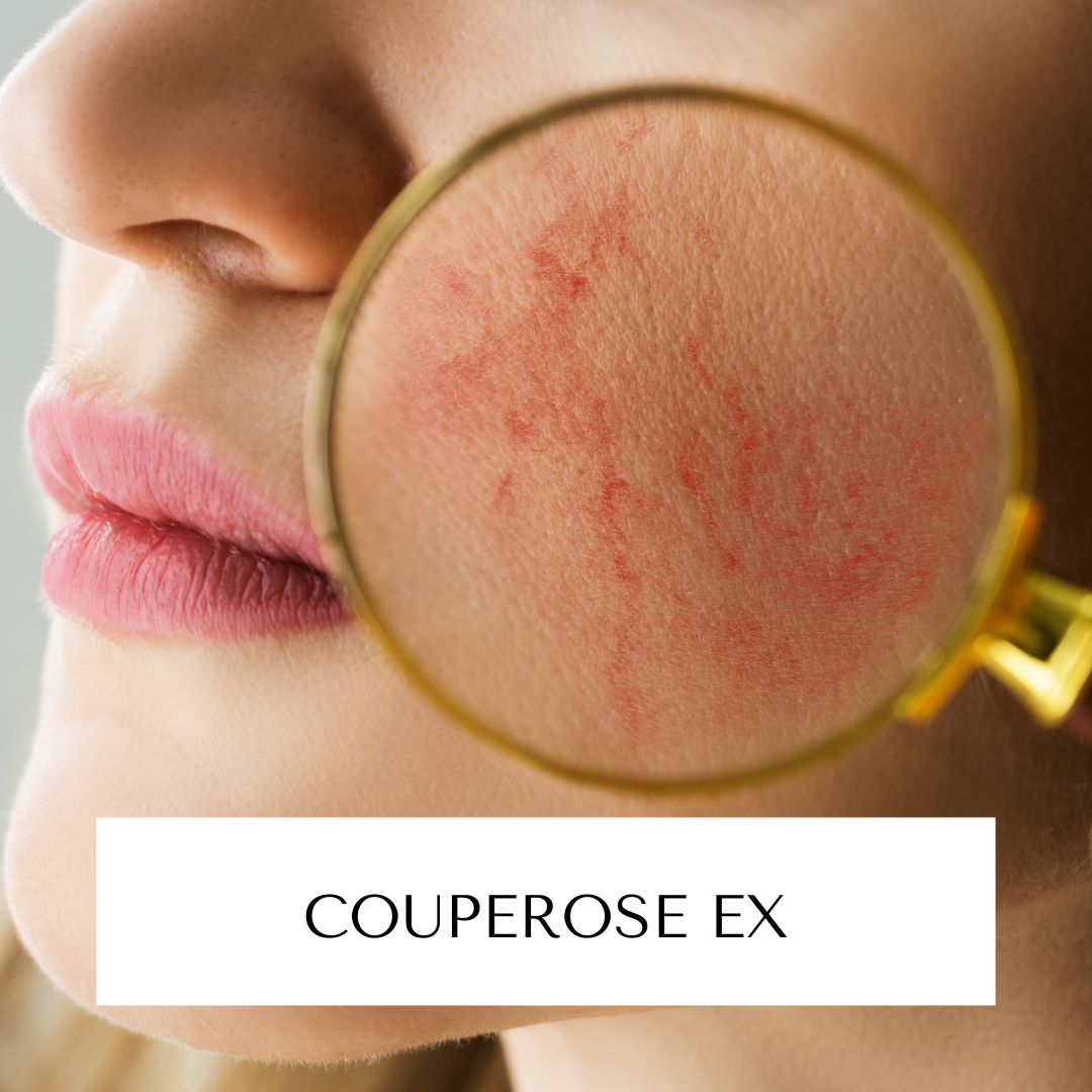 Couperose Ex | Microneedling inkl. Pflegecreme