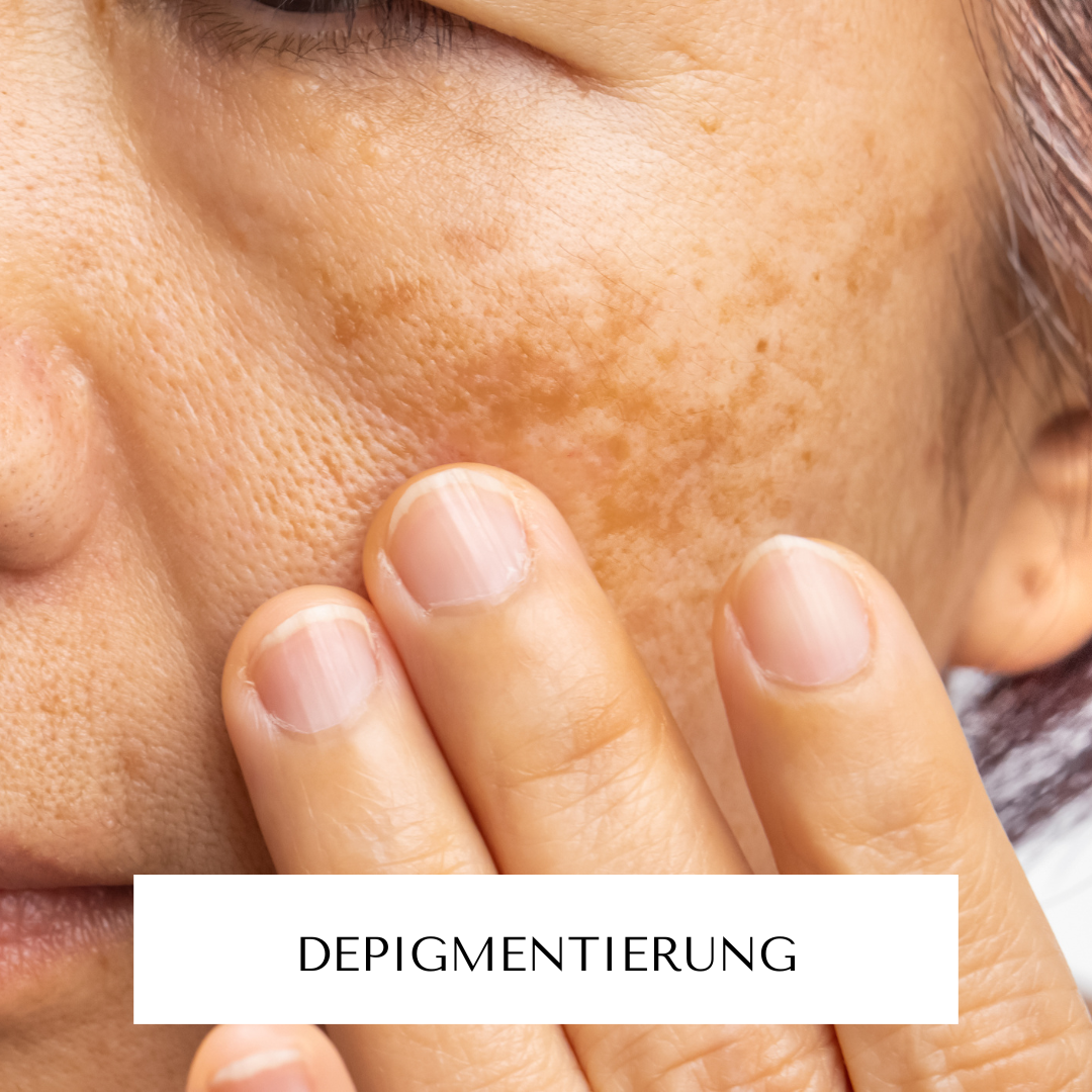 Depigmentierung gegen Pigment- u. Altersflecken