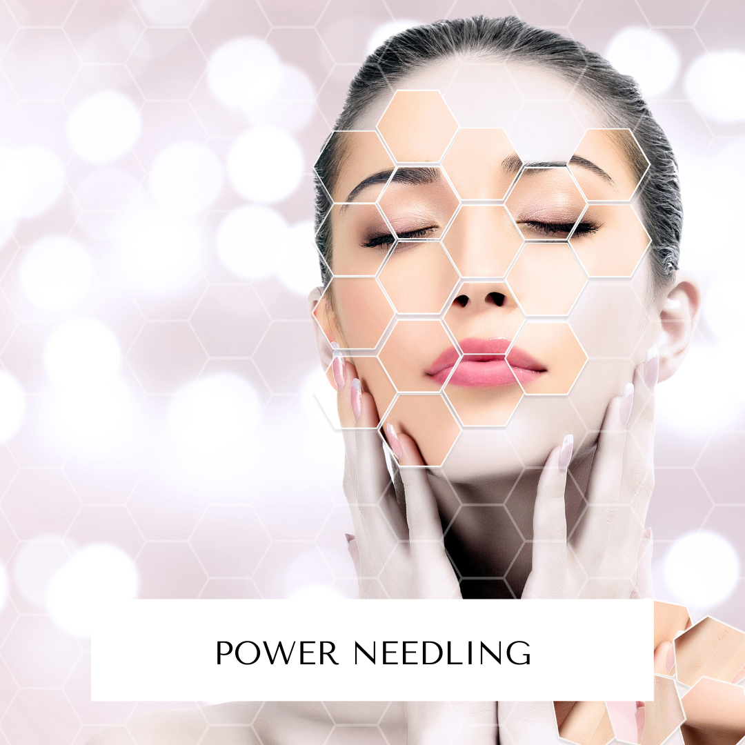 Power Needling mit 3 verschiedenen Seren | Gesicht