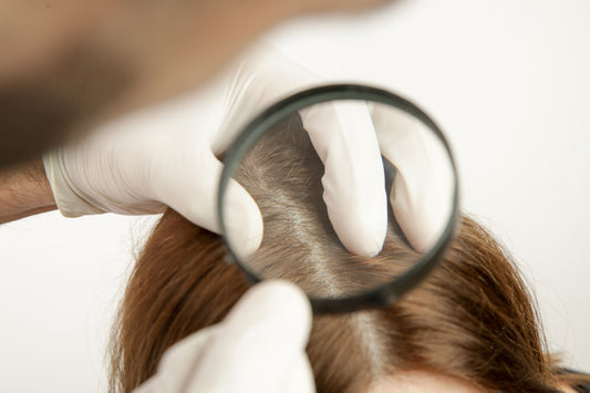 Kopfhaut-Needling - bei Haarausfall und für besseres Haarwachstum